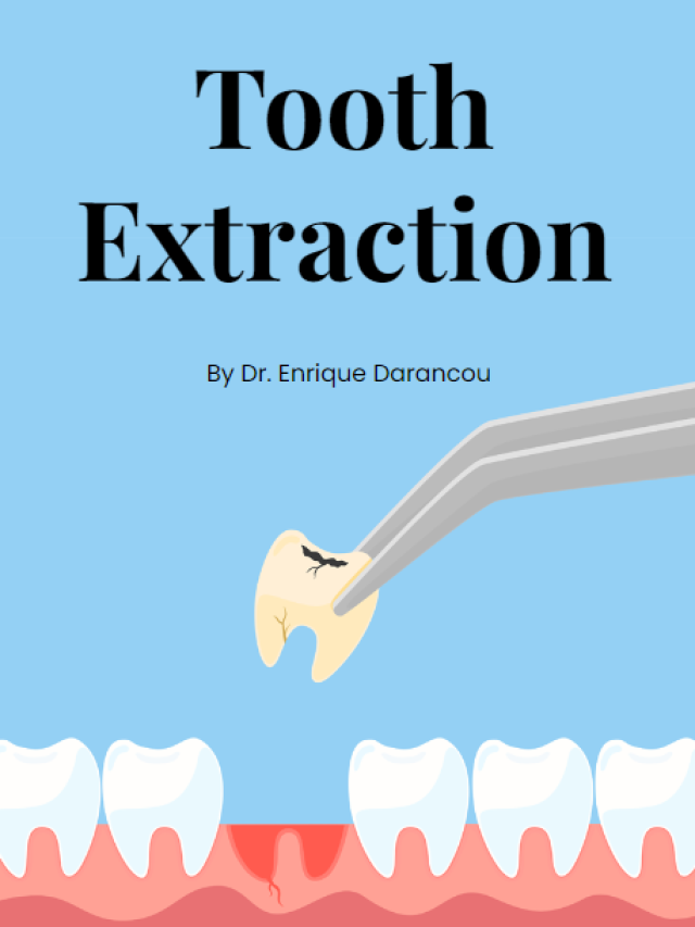WHAT IS TOOTH EXTRACTION?