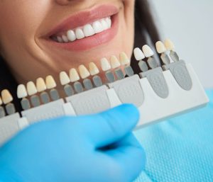 Natural Looking Veneers in El Paso TX Area