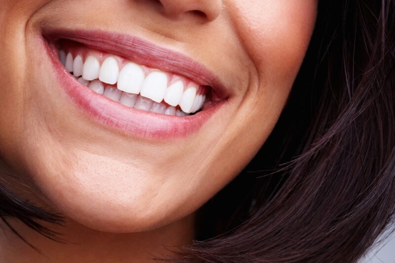 Cosmetic Dentistry El Paso